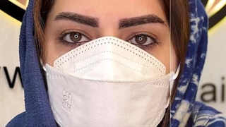 کاشت ابرو در کرج | ابروهای خوش‌فرم، اعتمادبه‌نفس بیشتر