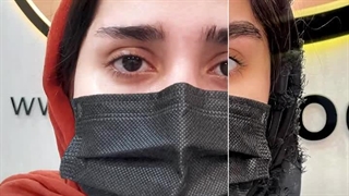 کاشت ابرو در کرج | زیبایی طبیعی با کاشت ابرو