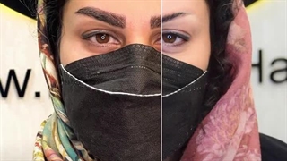 کاشت ابرو در کرج | کاشت ابرو، گامی به سوی جذابیت