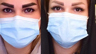 کاشت ابرو در کرج | ابروهای بی‌نقص، اعتمادبه‌نفس بی‌نهایت