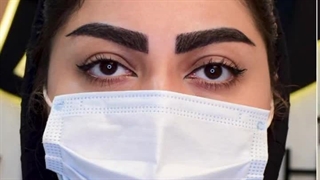 کاشت ابرو در کرج | ابروهای پرپشت، زیبایی بدون مرز