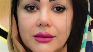 کاشت ابرو در کرج | کاشت ابرو، زیبایی بدون دردسر