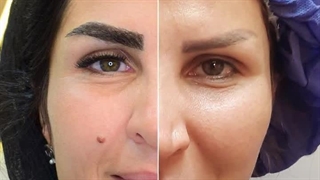 کاشت ابرو در کرج | کاشت ابرو، امضای زیبایی شما