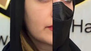 کاشت ابرو در کرج | زیبایی ابروها، جذابیت چهره شما