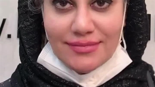 کاشت ابرو در کرج | ابروهای رویایی با انتخابی هوشمندانه