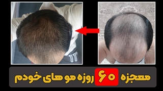 معجزه 60 روزه موهای خودم