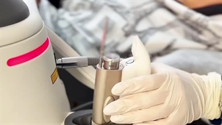 لیزر فوتونا برای صورت دندانپزشک زیبایی