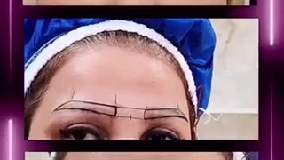 کاشت ابرو در کلینیک آوینا
