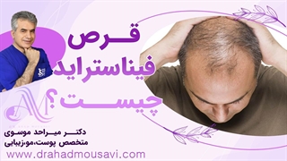 «قرص فیناستراید چیست؟ بررسی مزایا، معایب و تأثیرات آن بر ریزش مو و سلامت مردان