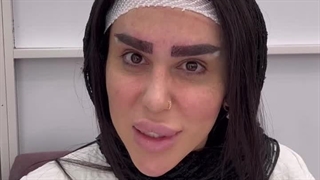 رضایت کاشت ابرو در مجموعه هیلدا