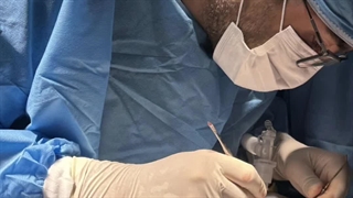 وقتی استخوان کافی برای ایمپلنت وجود نداشته باشد باید چه کاری کرد؟