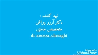 کدام پوزیشن جنسی باعث پسر شدن جنین می شود؟