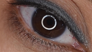 قبل و بعد کاشت ابرو در نوین ایرانا | نتیجه‌ای که باور نمی‌کنید واقعی باشه!