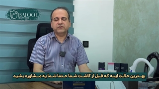 آزمایش‌های قبل از کاشت مو