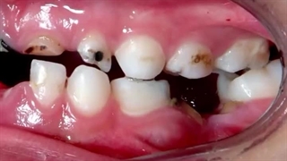 قبل و بعد مراجعین عزیزمون