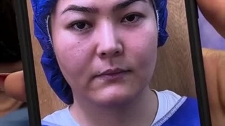 قیمت و هزینه بلفاروپلاستی - کانتوپلاستی