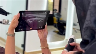 جوانسازی پوست