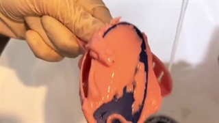 قالب گیری اولیه برای فک بالا