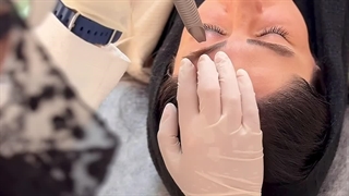 لیزر فوتونا 4D چیست؟