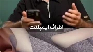 کاشت ایمپلنت دندان اصلا پیچیده و سخت نیست