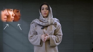 مزایای استفاده از دستگاه لیزر سایناشور