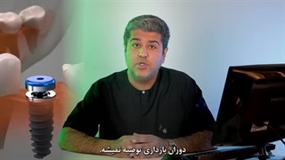 آیا در دوران بارداری می‌توان ایمپلنت دندان گذاشت؟