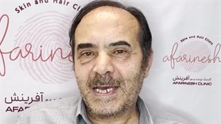 رضایت زیباجوی آذری زبان پس از انجام بلفاروپلاستی در کلینیک آفرینش