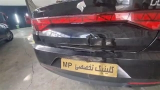 لیسه گیری کلینیک تخصصی MP | ماشین پرومکس