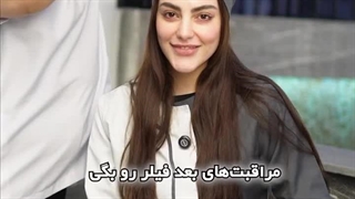 بعد از تزریق فیلر حتما این نکاتو رعایت کنین