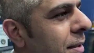 جراحی پیشانی برجسته(ناندرتال) و جراحی زیبایی بینی همزمان و لیفت پیشانی و ابرو