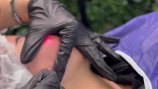 با اندولیفت گونه، چهره ای جوان تر و زاویه سازی جذاب تر تجربه کنید!