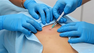 فیلم روش جراحی بسته دیسک کمر | بدون برش و بخیه