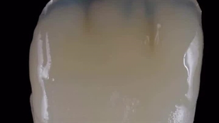 وقتی توی کلینیک نوتاش کامپوزیت انجام میدی!