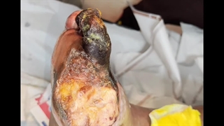 بررسی بیمار (متمم_زخم) 4