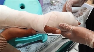 بررسی بیمار (متمم_زخم) 6