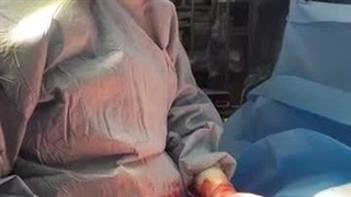 درمان خونریزی گوارشی با جراحی (قسمت اول)