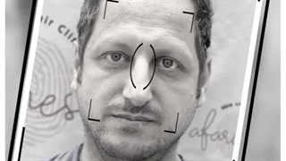 کاشت-ابرو-آقایان