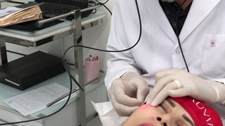 لیفت صورت با دستگاه اندولیفت