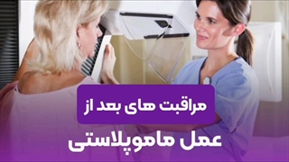 مراقبت های بعد از عمل ماموپلاستی