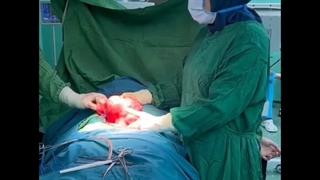 کیست تخمدان