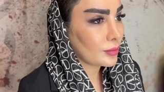 لیفت ابرو با جدیدترین متد و بدون عوارض