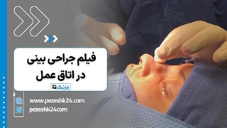 فیلم جراحی بینی در اتاق عمل - پزشک 24