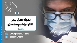 نمونه عمل بینی دکتر ابراهیم محمدی در تهران - پزشک 24