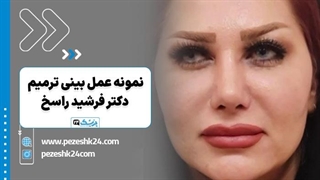 نمونه عمل بینی ترمیمی دکتر راسخ اصفهان - پزشک 24