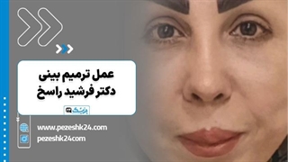 عمل بینی ترمیمی دکتر فرشید راسخ اصفهان - پزشک 24