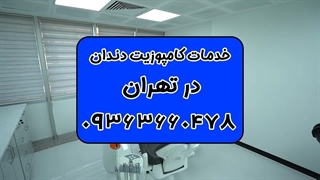شماره بهترین دندانپزشک کامپوزیت در تهران 09363660478