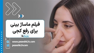 فیلم ماساژ بینی برای رفع کجی - پزشک 24