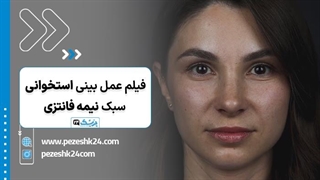 عمل بینی استخوانی به سبک نیمه فانتزی - پزشک 24