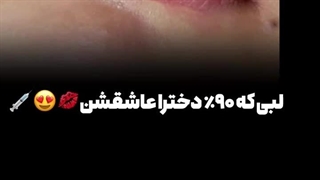 تزریق فیلر لب در فردیس