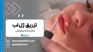 نمونه تزریق ژل لب دکتر سمانه میرتوکلی در مشهد - پزشک 24